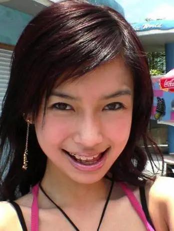 明星网红整的牙,蜕变之路，牙齿见证美丽蜕变