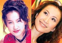 明星网红整容对比图片,揭秘美丽背后的真相