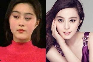 明星网红整容对比图片,揭秘美丽背后的真相
