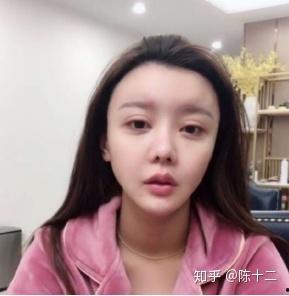 隆鼻明星网红是谁,她是如何塑造完美鼻型的？